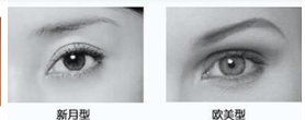 南京做双眼皮做全切保持多久?