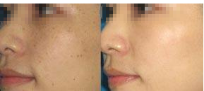 �Ͼ�ȥȸ�߶���Ǯ��