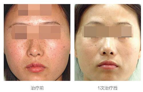 �Ͼ�������ȸ����Ч��