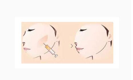 �Ͼ�ע���ƻ����Ч������