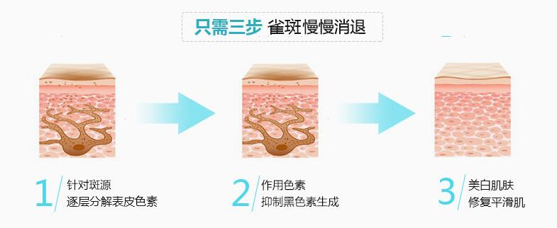 南京光子嫩肤祛斑术后会反弹吗?