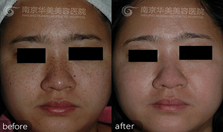 �Ͼ��沿��ȸ����ô��